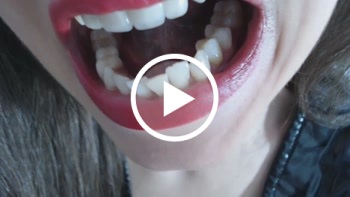 pb xl f9deede47b06bfd23a66e564ce5ac84b 1 - close-up of mouth and teeth - videos, Video, up, TEETH, softcore, soft, po, of, mouth, goddess, gel, Fetish, Fetish, Close, Allgemein, 13