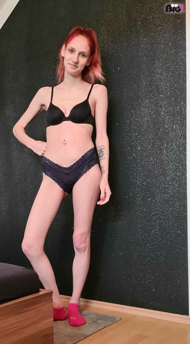 Red-Skinny