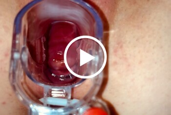Spekulum - Teen Pussy wird komplett gespreizt! - Private Porn - Jetzt ansehen